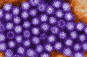 Norovirus